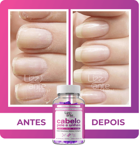 Unhas Fortes e Bonitas - resultado de antes e depois co