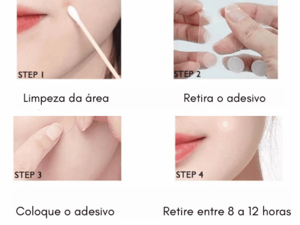 adesivos secativos - Passo a passo para usar o adesivo secativo do jeito certo - passo a passo de como colocar o adesivo secativo de acnes.